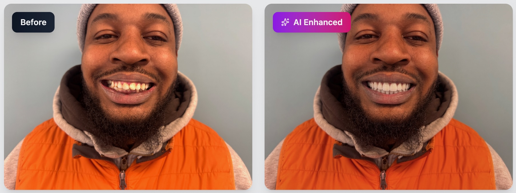 Before and after smile makeover